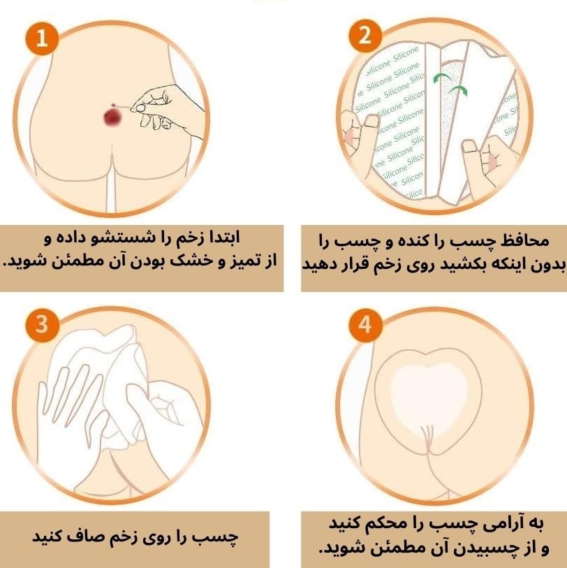 روش استفاده از چسب زخم بستر