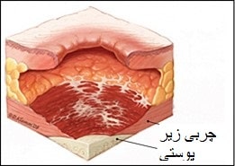 ارزیابی زخم بستر 3