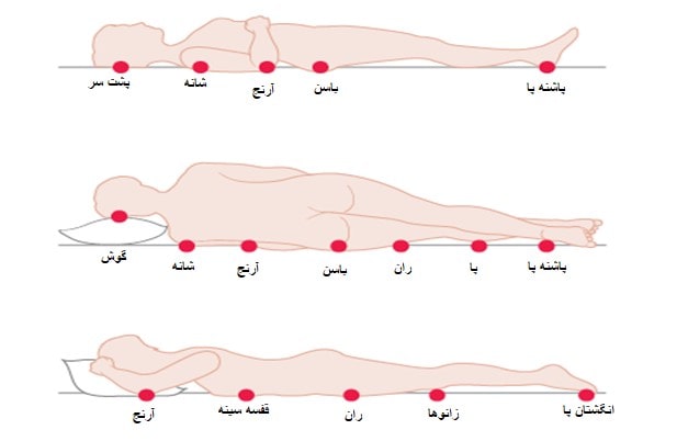 نقاط احتمالی پیدایش زخم بستر