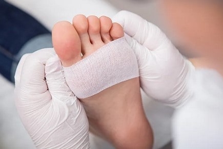مراقبت از پای دیابتی: مراقبت‌های لازم در برابر عفونت